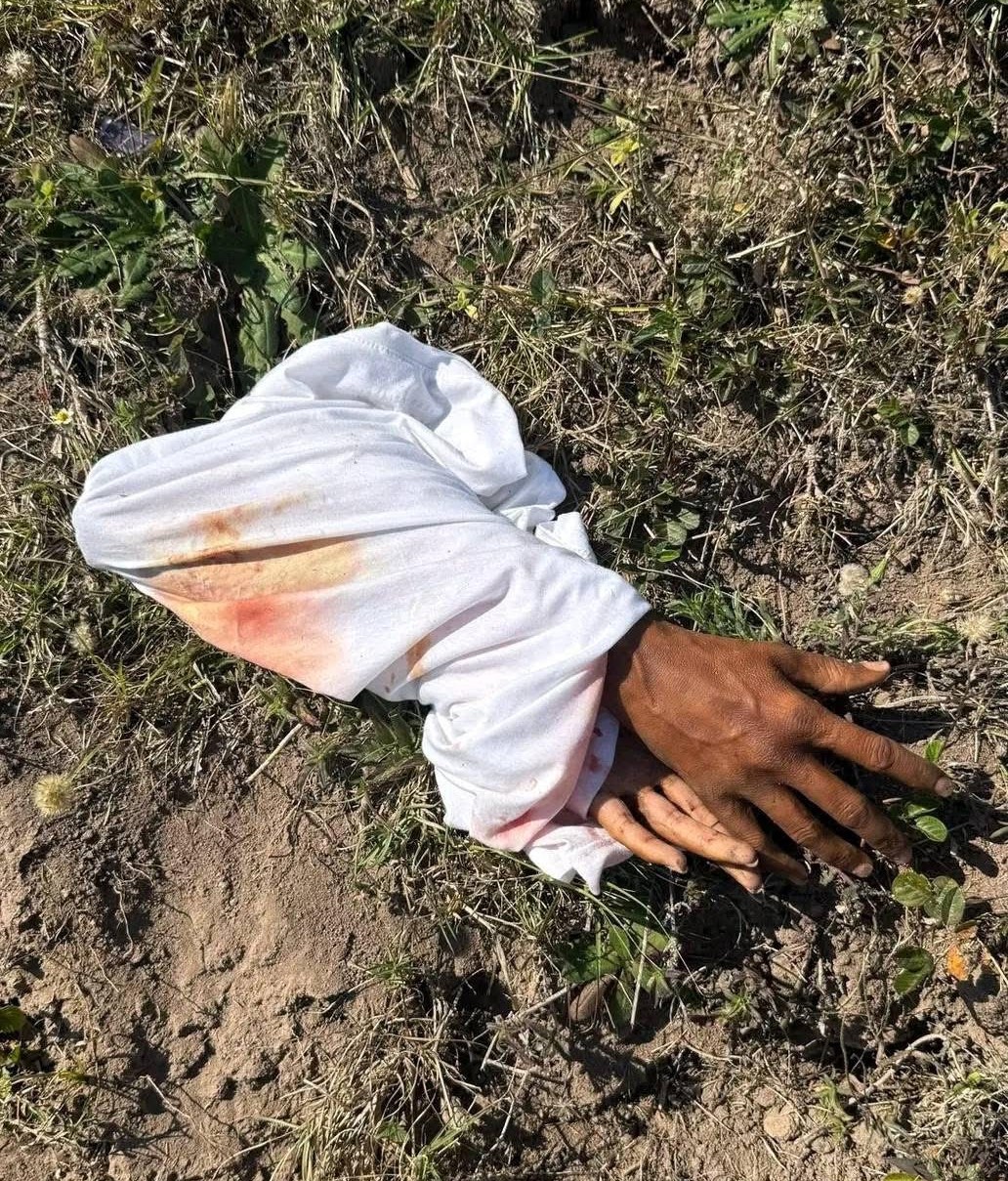 Shock as human hands found near a primary school in KZN