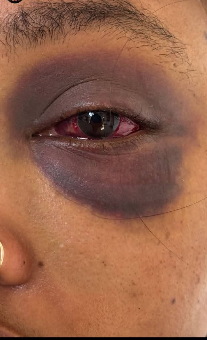 24-year-old man in custody for assaulting 31-year-old girlfriend